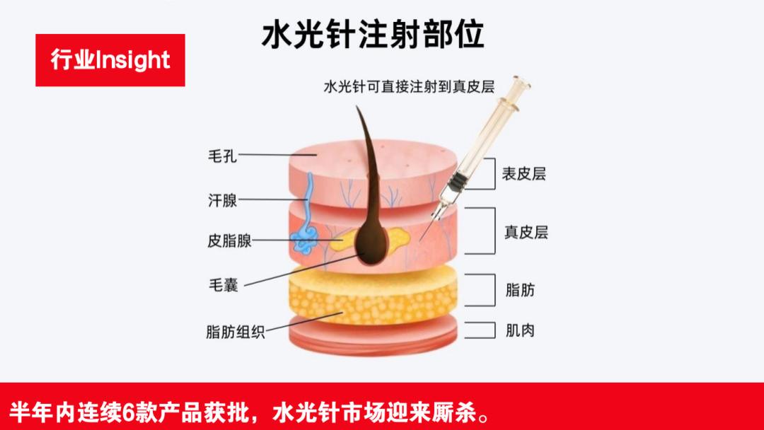 水光针市场大变天！半年内获批6证，超40家企业围猎