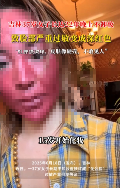 “代价终于来了！”吉林，一37岁的女子，因为懒得卸妆，整整22年都只靠清水洗脸，