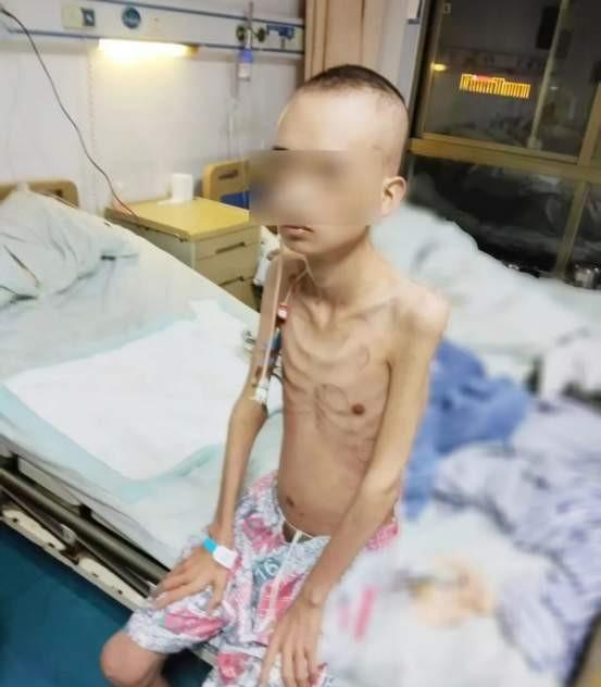 这个男子瘦成了这个样子，看了着实让人心痛，据说这个男子因为生病才瘦成这个样子，当