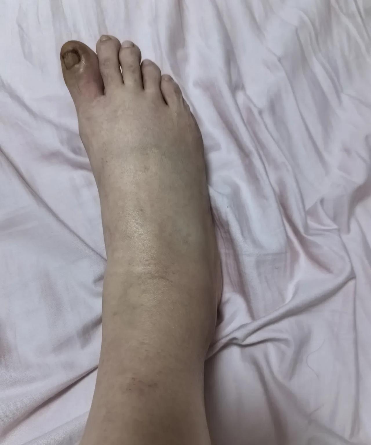 要不是我脚伤成这样
我才不会脑袋犯抽
把车停在学校门口接孩子放学
平常都是停在路