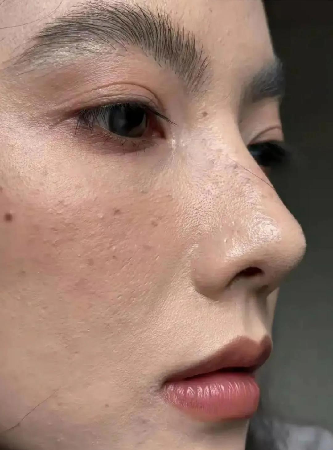 原来大美女张柏芝的素颜高清照脸上斑斑点点，痘痘丛生，毛孔也粗大，你看是这样吗？