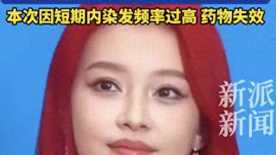 孙怡自曝染发过敏，满脸发肿严重到无法见人，因染发吃三天过敏药