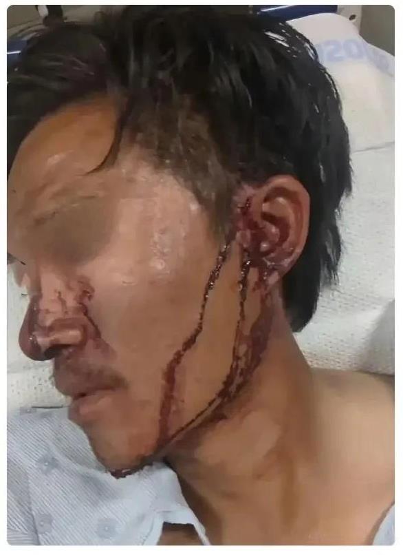 电子宠物 甜甜圈 据说遭受了大老黑的毒打，血流满面，估计很难度过2025。
  