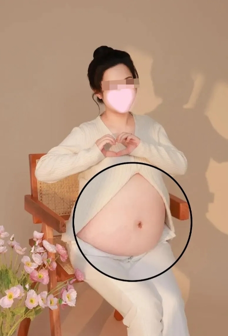 一觉醒来
董小姐事件迎来了的一个好消息，一个坏消息
好消息是国家卫健委开始调查，