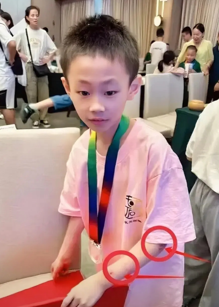 九岁的围棋天才朱宏鑫走了， 他不是死于意外，不是死于岁月， 也不是死于贫穷，没想
