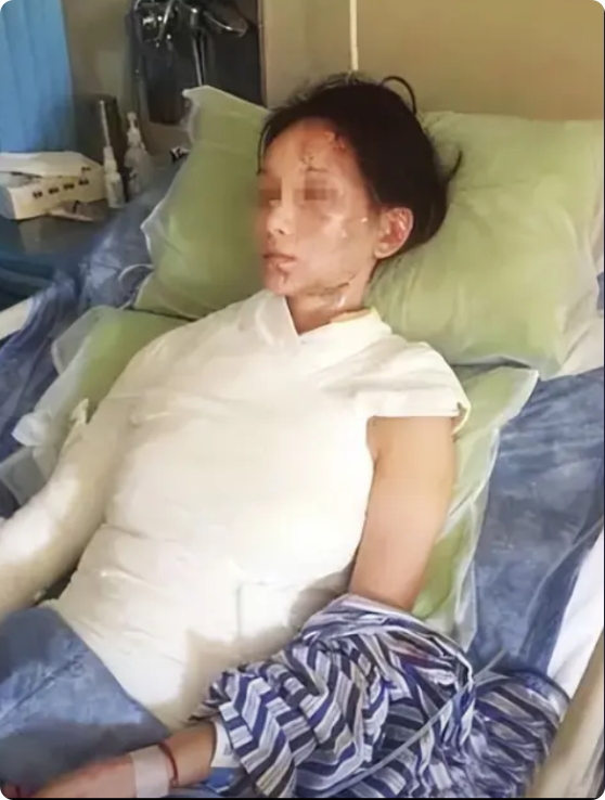 2015年8月，浙江一女子在吃火锅时请求服务员加汤，由于顾客较多，服务员五分钟后
