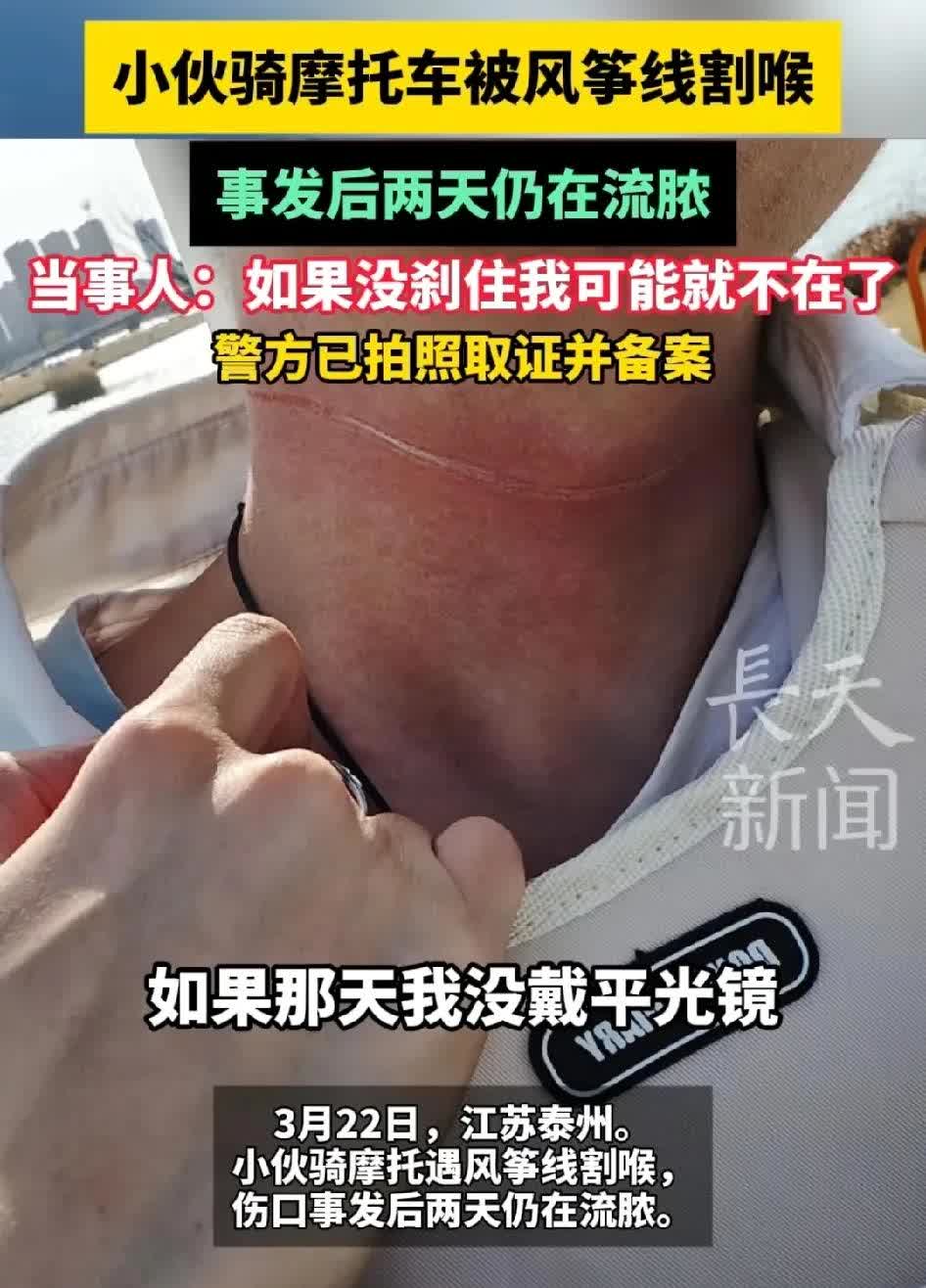 太吓人了！风筝线成“暗器”，摩托小伙惨遭割喉？
春日里大伙都爱放风筝，可这风筝