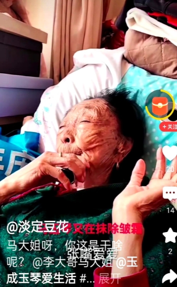 李玉成的老宝贝马玉琴马大姐，每天起来都要擦一遍去皱霜，已经做大拉皮反弹到皮肉分离