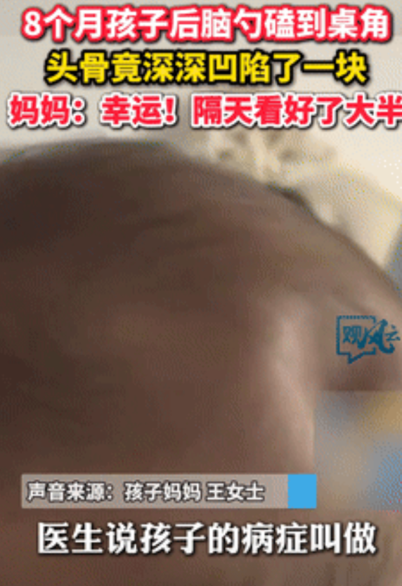 “人类幼崽的自愈能力！”8个月婴儿从沙发摔下，后脑勺竟磕出一大凹坑！可万万没想到