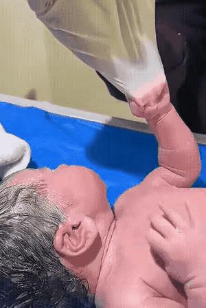 一才出生的小婴儿闭着眼睛哇哇大哭，一只手像抓住救命稻草一样死拽着护士的衣服，一只