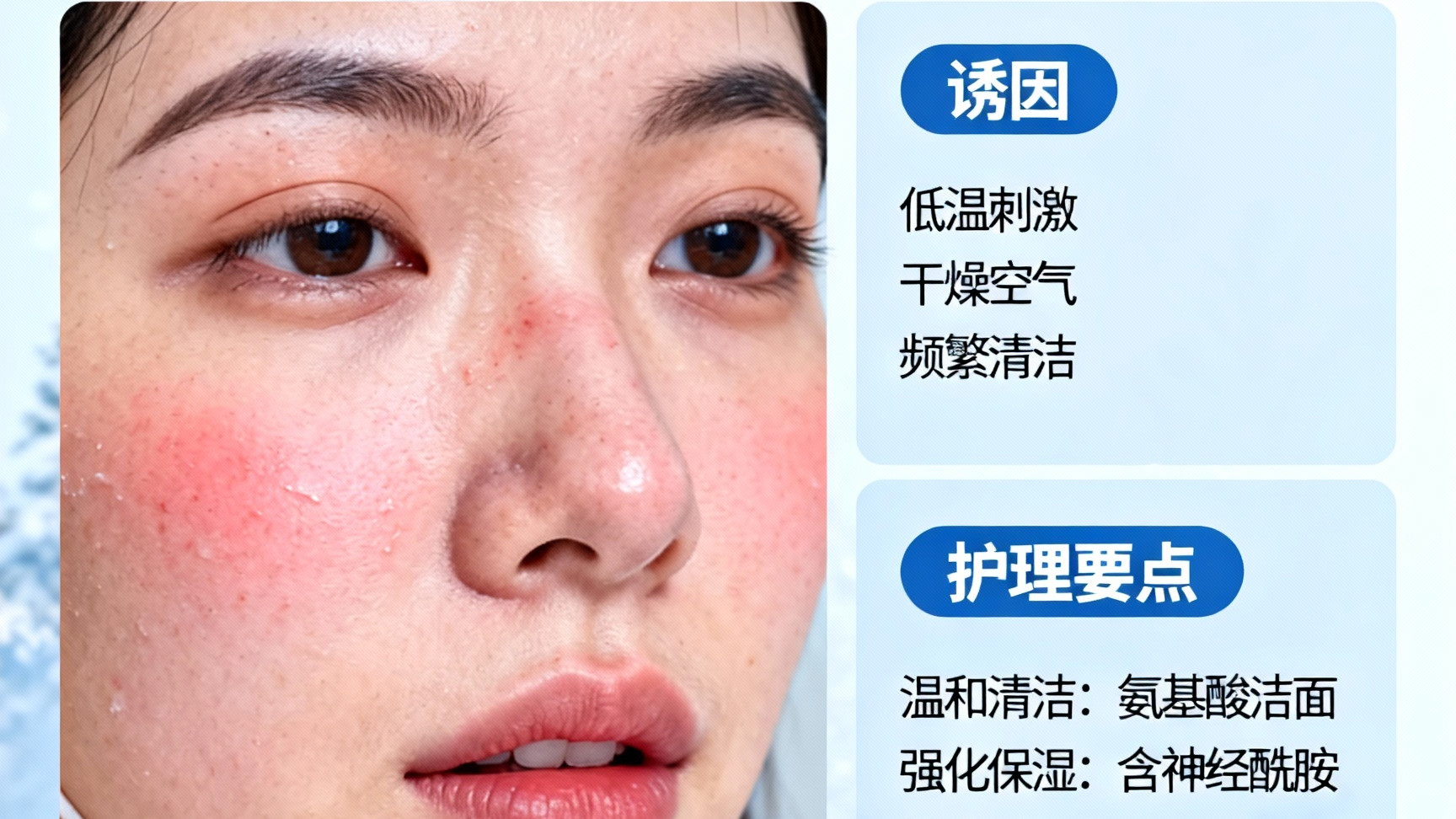 ❄️杜一生科普：进阶护肤与季节性护理~【冬季皮肤敏感】