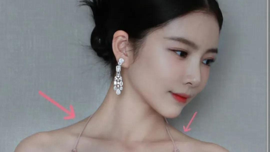 杜淳老婆医美翻车，王灿打肉毒素过敏进医院，后背全是红色抓痕