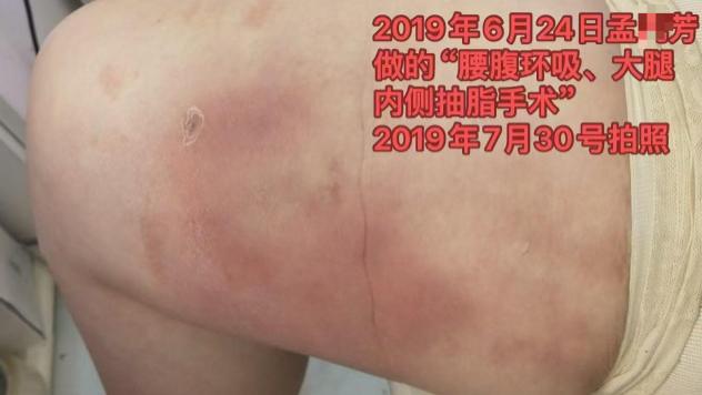 苏州木渎“非法行医”酿惨祸，执法司法“变形”引公愤