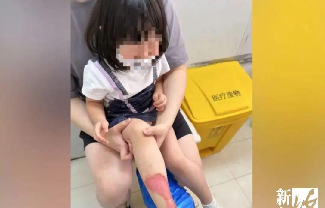 上海，一家火锅店内，服务员给女子一家加汤时，盛满滚烫花胶鸡汤的水壶手柄突然断裂，