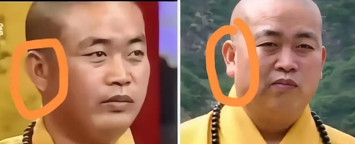 释永信的耳垂是假的？
网友说这是打了玻尿酸

为什么这样子说呢
有网友扒出释永信