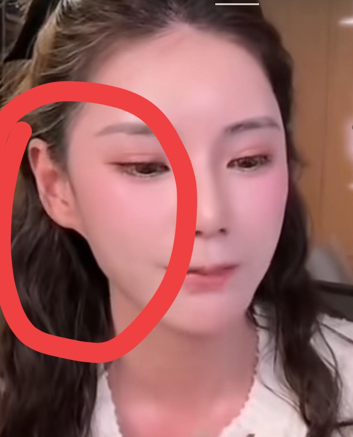 马筱梅的耳朵太奇怪了，估计以后就是刘晓庆那样。
马筱梅的耳垂跟脸好像有块皮使劲拽