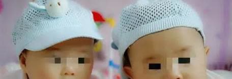 某女子产下双胞胎，事后丈夫要求做亲子鉴定，结果发现两个孩子有两个父亲，只有一个和