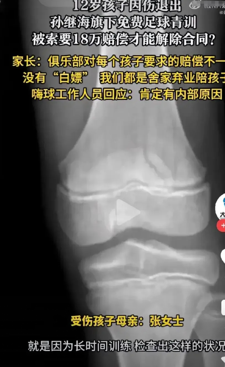 要搞明白真实原因，如果他以后不踢球了，可以不让他赔钱。如果换个俱乐部继续，必须得