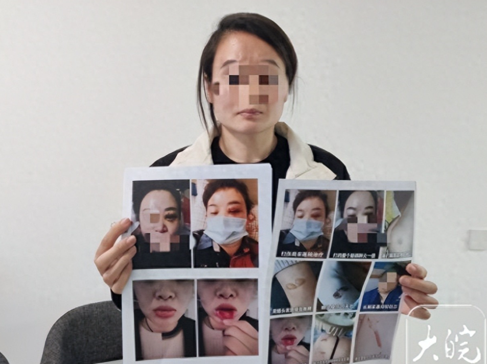女子被企业家丈夫逼着喝尿吃口水，孕期仍不放过，曾4个月流产2次