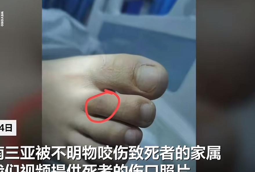 三亚被蛇咬身亡一事，
给所有去热带地区旅游的人上了一课，
无论天气有多热，也无论