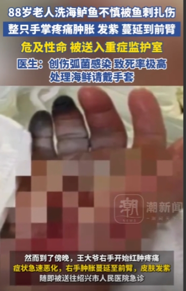 “差点被鱼了解”一大爷处理一条鱼，手被鱼刺扎了一下，本以为只是小伤口，谁知接下来