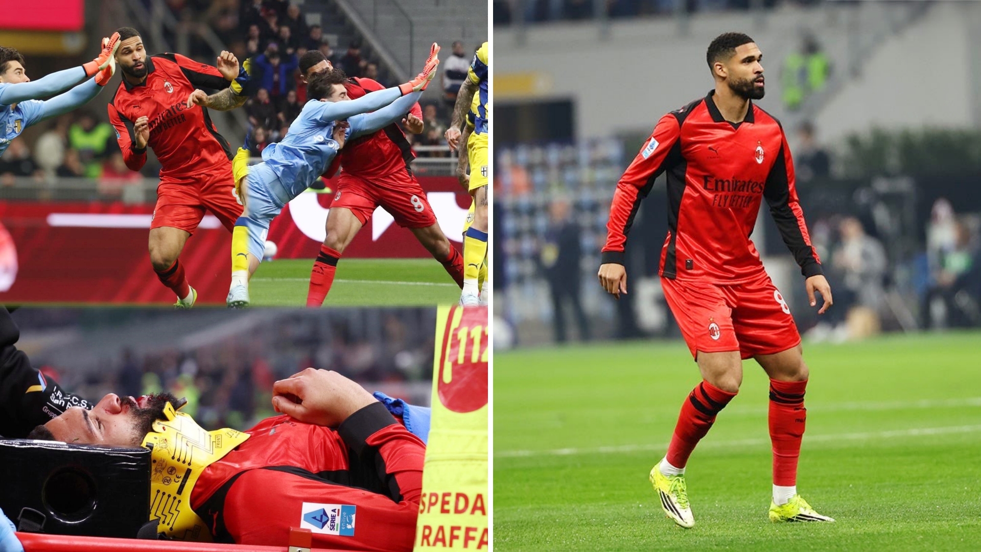 米兰官方消息，奇克下颌牙槽骨骨折，已成功接受了手术。
球员状况良好并已经出院，预