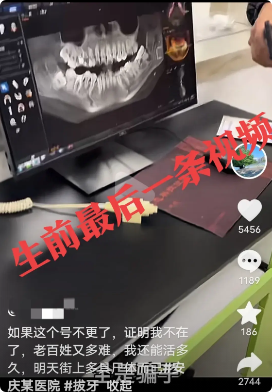 她太绝望了！安徽安庆，李女士拔智齿，却被牙医拔了好牙，求助无门，发了最后一条短视