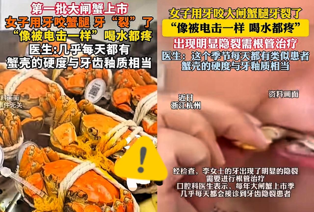 近日，浙江杭州，一女子在家吃螃蟹，她用牙齿咬开螃蟹腿时，突然感到一阵剧痛，随后竟