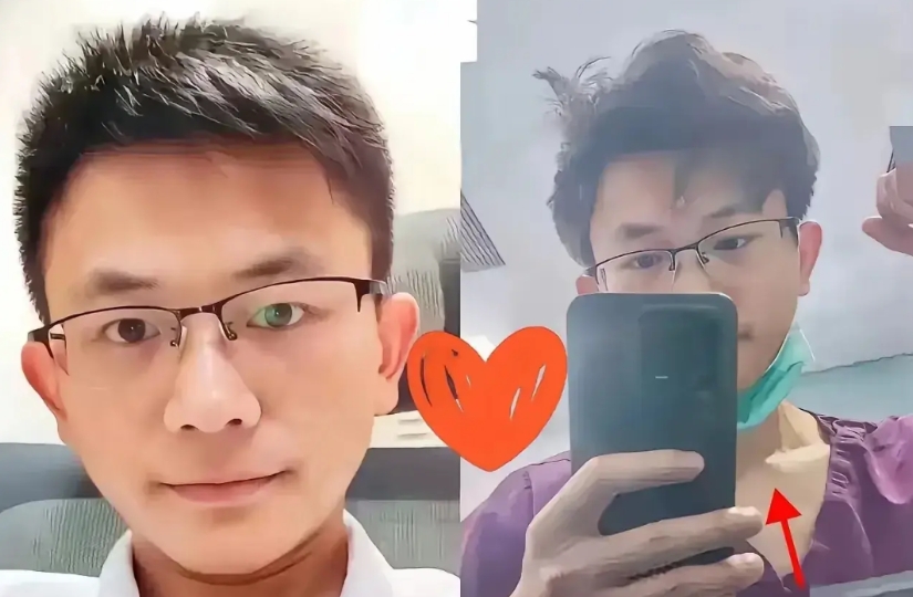 罗帅宇医生还是太年轻了，他在举报违法犯罪事件中，忘记保护自身安全了。

湘雅附二