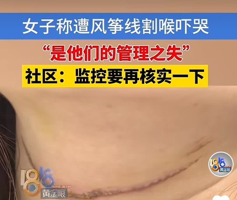 浙江嘉兴，女子和丈夫骑电动车去买菜，在公园附近的一条路上被风筝线割喉，感到喉咙火