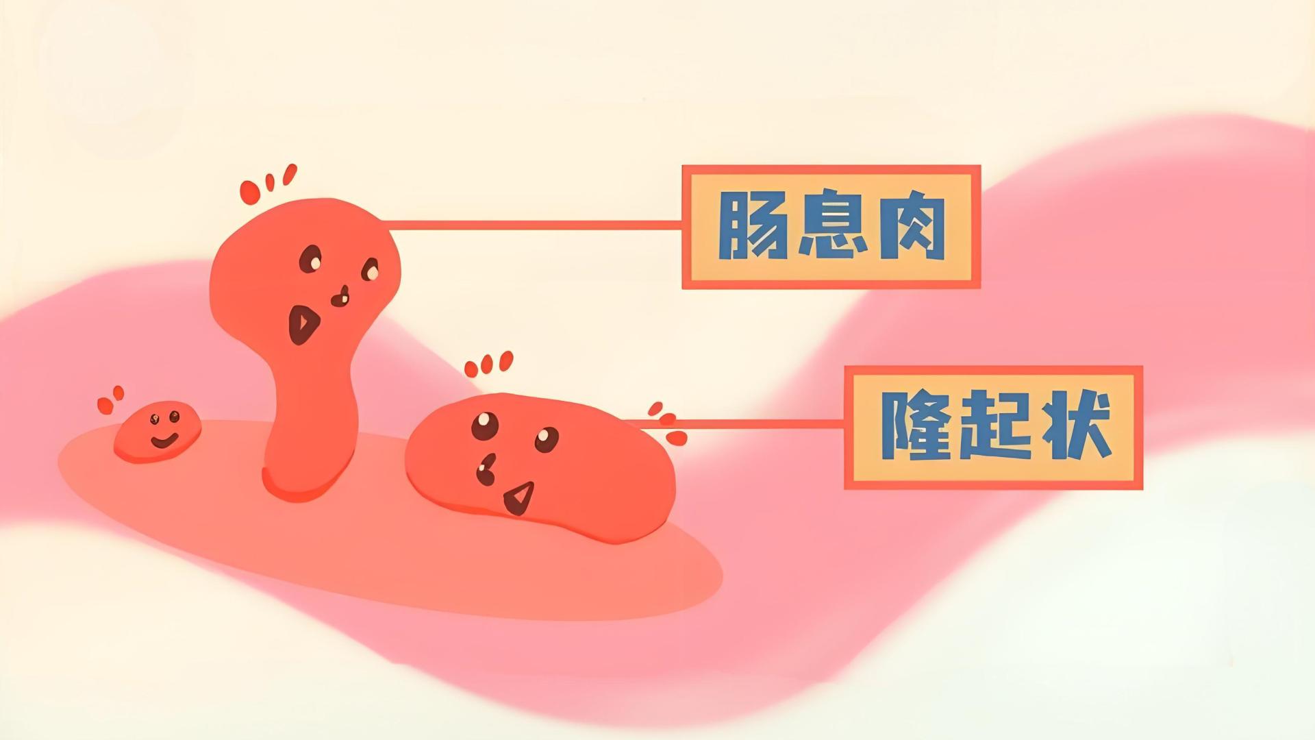 肠息肉能自行好转？别被误导了，正确做法看这里！