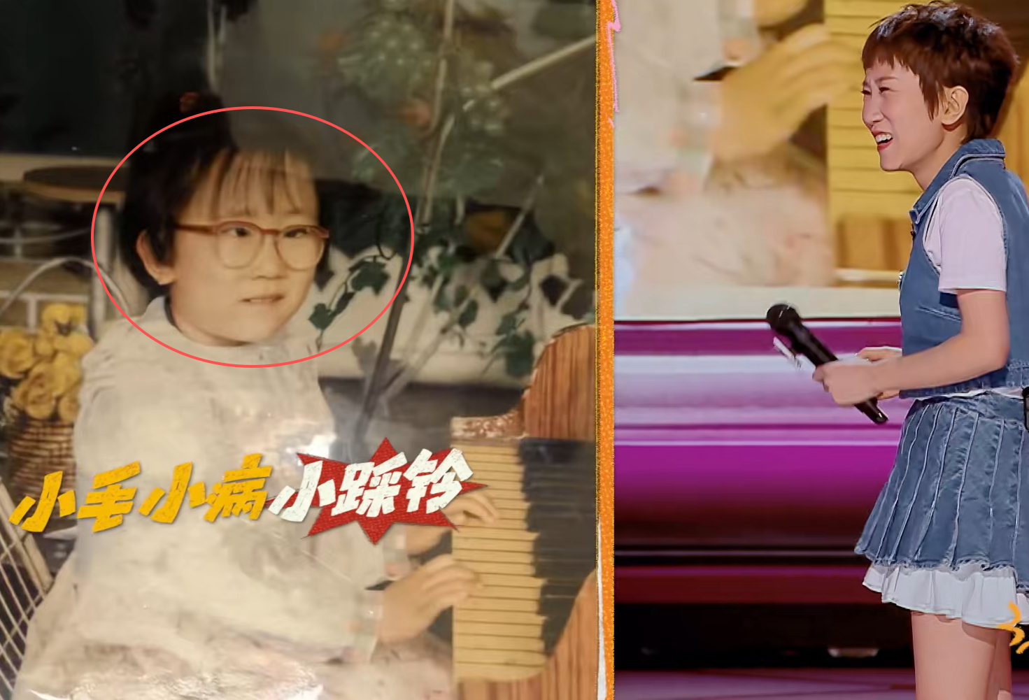 张踩铃在《喜剧之王单口季2》比赛中，讲述自己小时候患上斗鸡眼的往事，她担心观众不