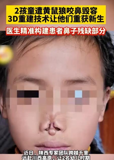 “这才是真正的专家！”四川甘孜，两名牧民的孩子因为小时候睡觉时，父母没有注意而被