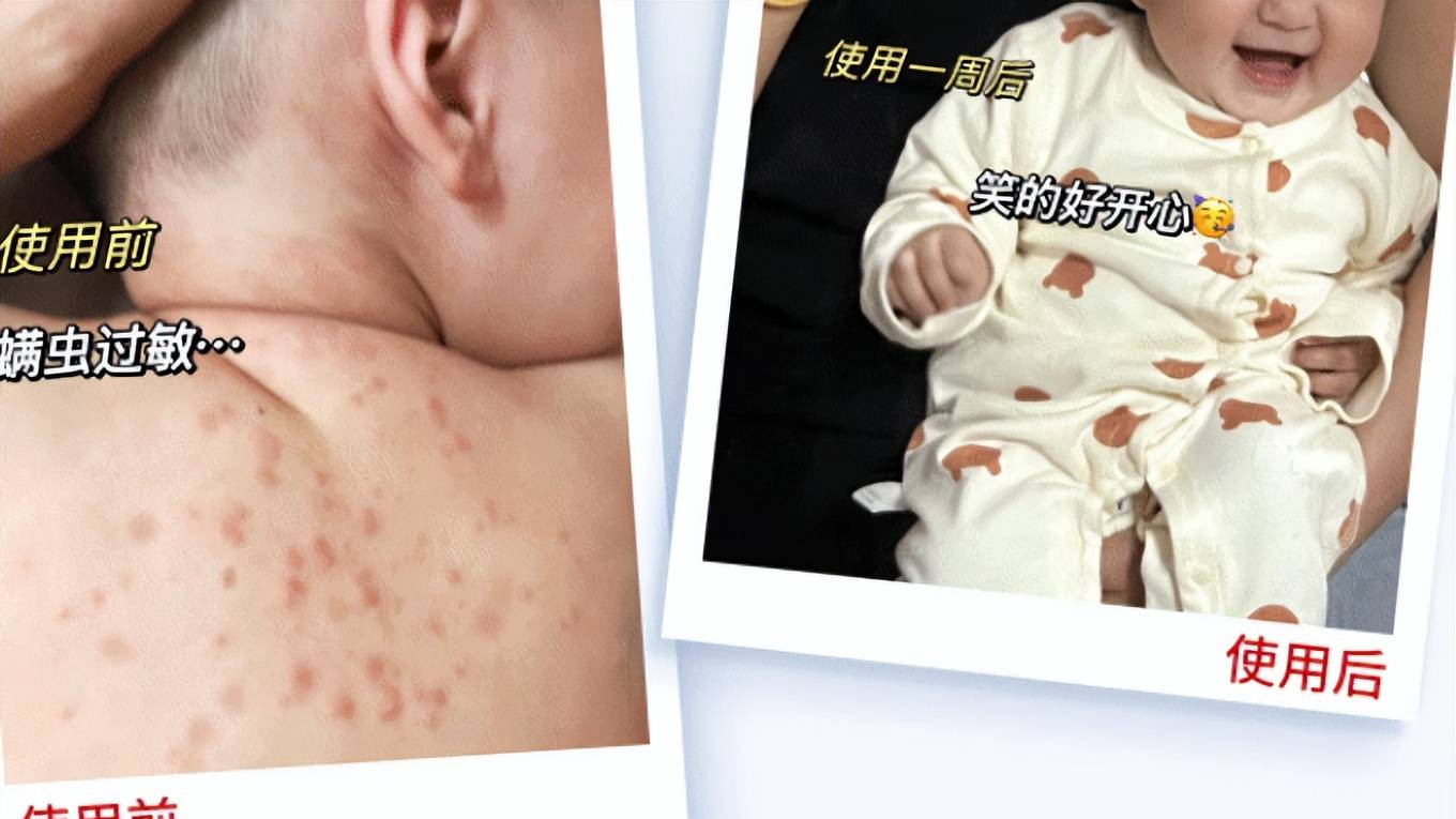 家庭用除螨仪哪个牌子好？除螨仪什么牌子好排行第一名？十大热门除螨仪品牌对比推荐，口碑好的都在这