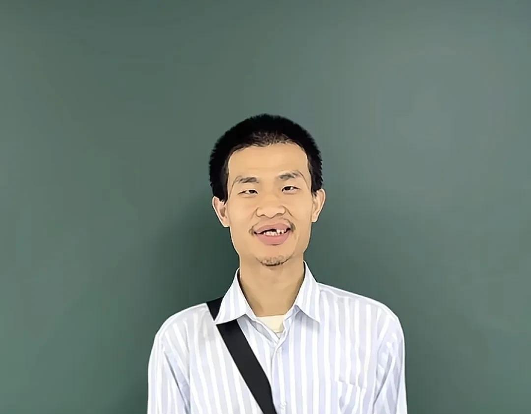 韦东奕的牙齿掉了，他堂哥说是牙周炎，但是看到他爸的照片，我觉得很可能和遗传有关系
