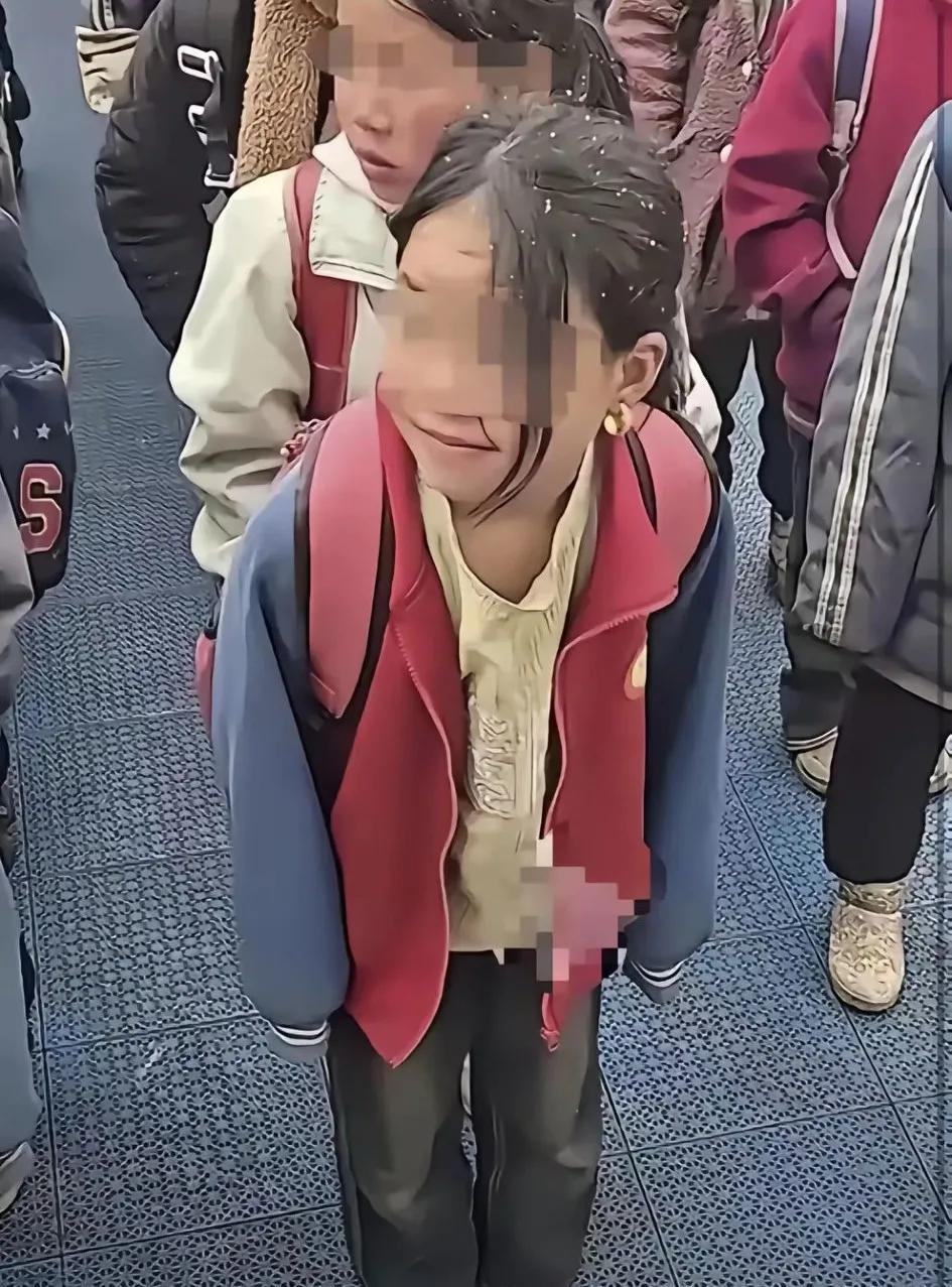 痛心！大冬天天，某学校一小学生衣裳单薄穿着凉鞋，迎着大雪瑟瑟发抖
那耳环是黄铜耳