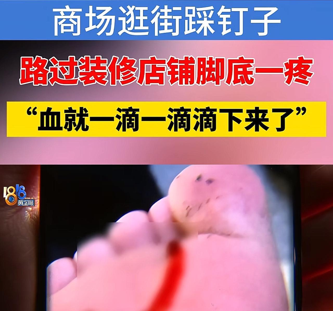 浙江杭州，一女子逛街时路过一装修商铺，岂料，不小心被钉子扎伤了脚，为此，女子花了
