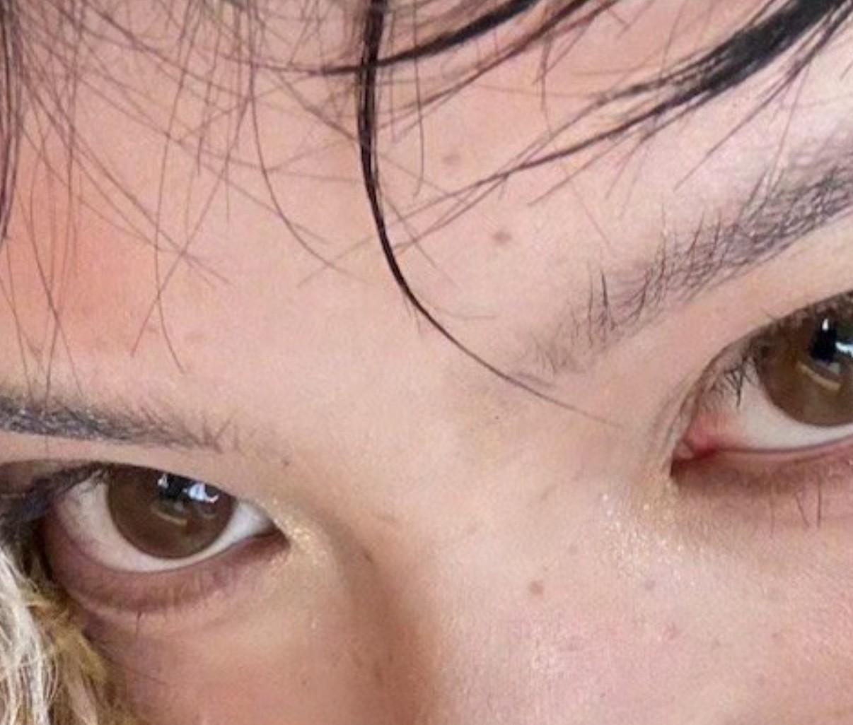 欧阳娜娜的脸上居然有这么多小斑点！