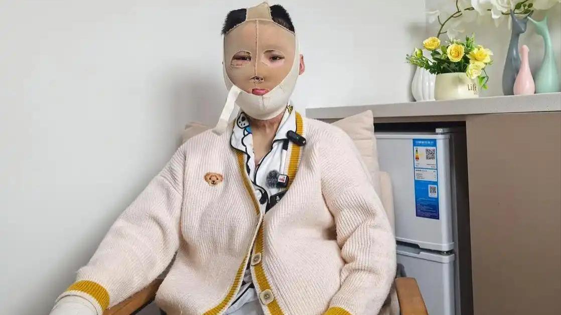 不听父母劝酿惨剧！95 后女子拒复合遭汽油焚身！20次手术难挽人生！