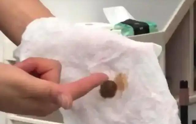 浙江杭州，粪水管接错自来水管引发污水，杭州多个街道小区的业主发帖称，自己家中的自