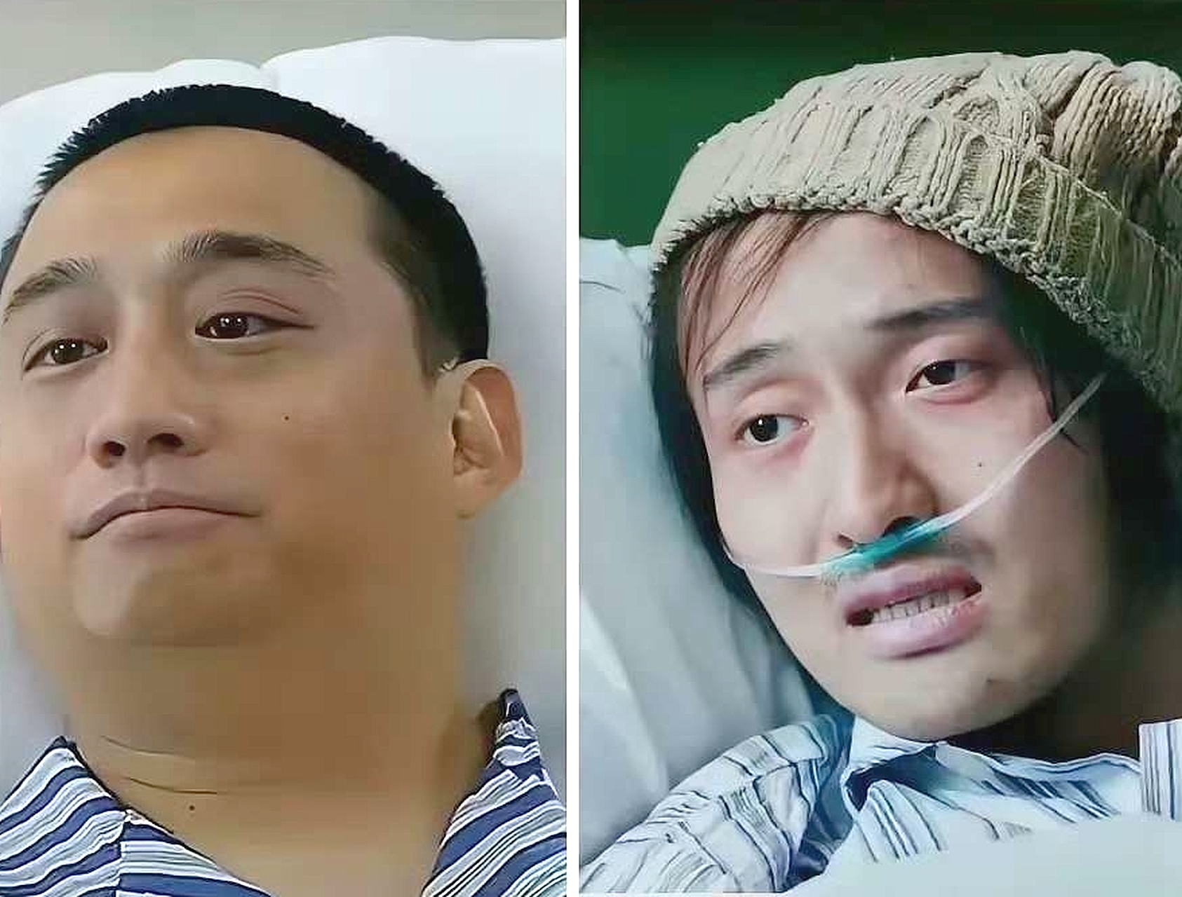 同样都是演癌症患者晚期，差距一目了然