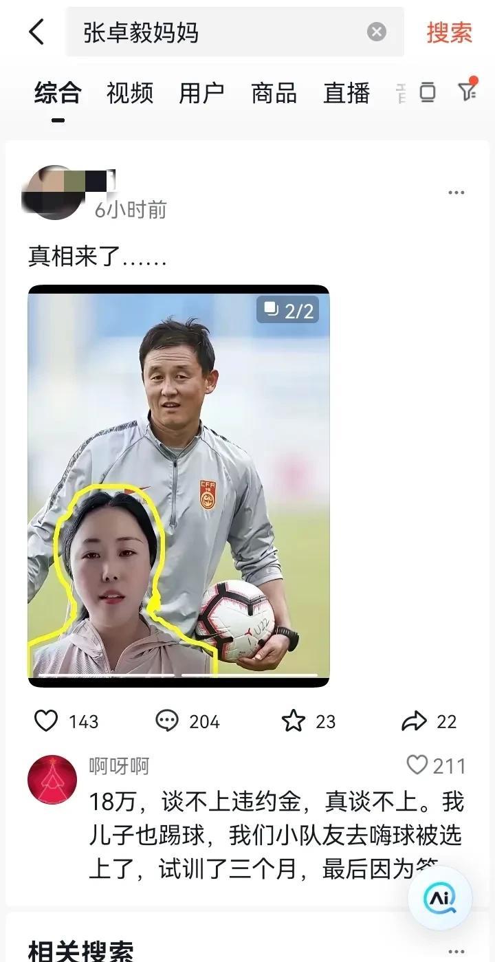 赔偿18万对于一个普通家庭来说，肯定是非常多的！
如果孩子不踢足球，1年4个月时