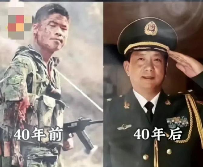 1984年老山战役，一名战士手臂被炸烂，他毅然用匕首斩断连着骨头的断臂，将其别在