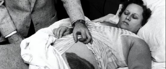 女子被陨石砸中











不可思议！1954年，美国女子安·霍奇斯午