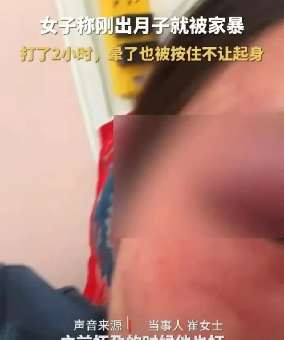 女子
刚生完孩子43天被家暴，足足打了2小时，打晕了也被按住不让起来，她还说怀