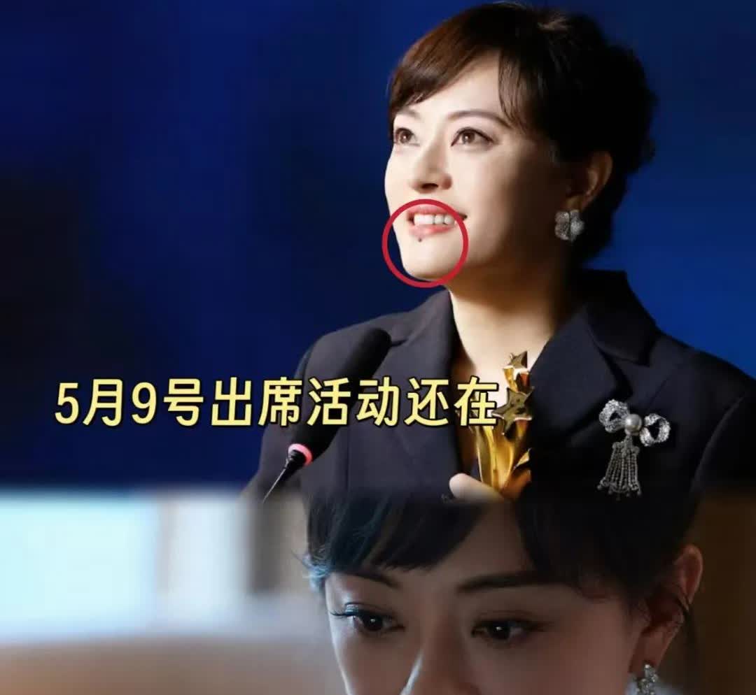 我怀疑孙俪把痣切了

不是因为担心影响颜值，毕竟脖子上的扁平疣她都没管，很有