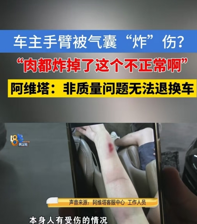 浙江，女子开车时发生碰撞，安全气囊没有包裹住方向盘，导致自己的手臂被炸伤。她怀疑