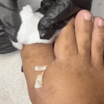 看得我脚指头都缩起来了[捂脸]