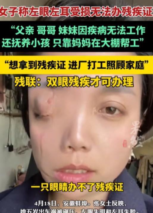 令人心酸！近日安徽蚌埠，独眼女子因左眼左耳受损，无法工作，想办个残疾证补贴家用，
