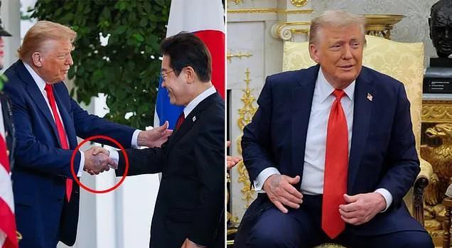 老特手背的淤青变深了，他今天与韩国总统李在明握手时瘀伤成黑色状。
虽然白宫新闻秘